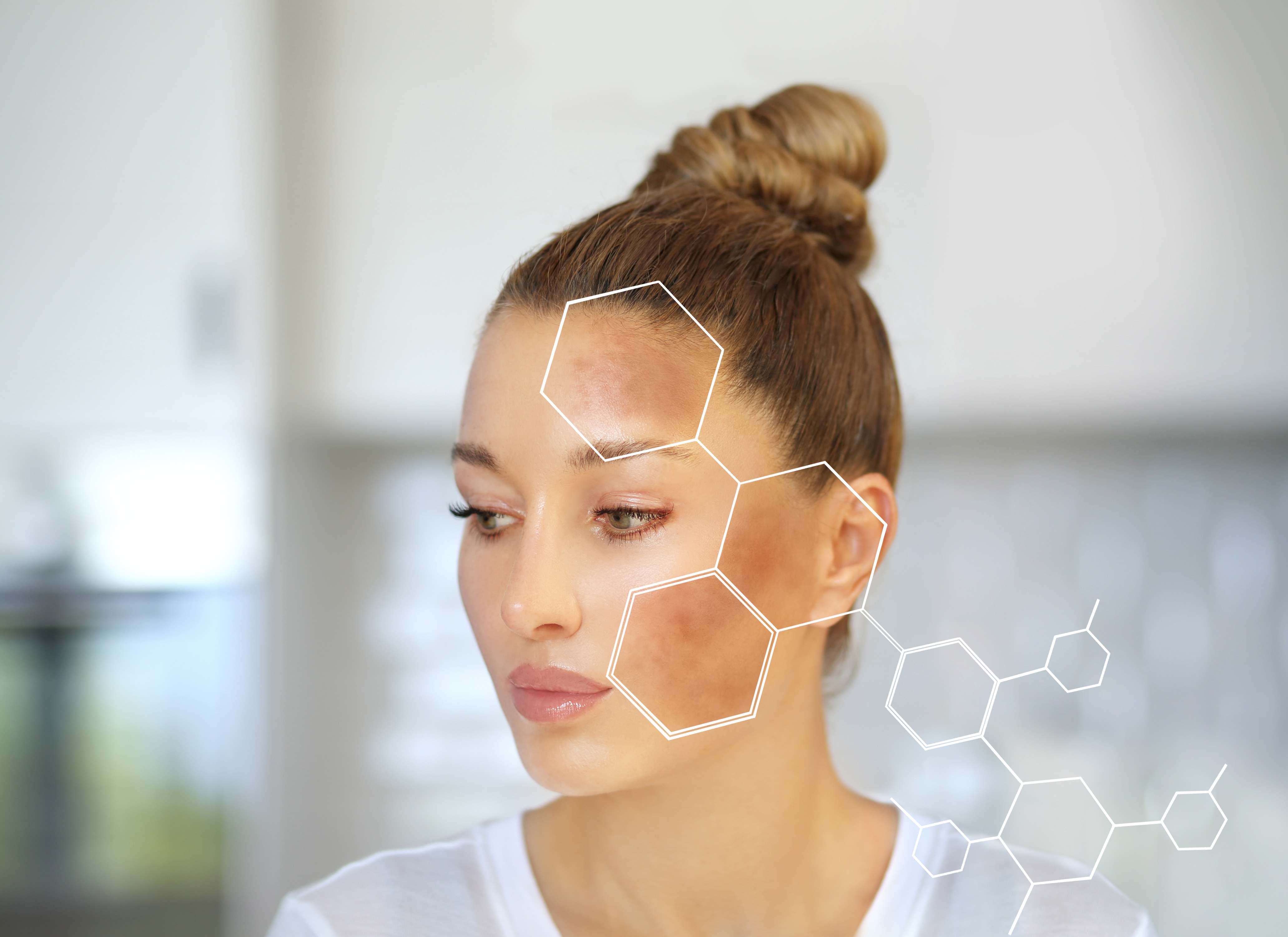 Co na przebarwienia na twarzy? Przewodnik po składnikach, kuracjach i zabiegach