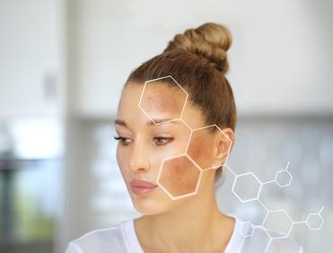 Co na przebarwienia na twarzy? Przewodnik po składnikach, kuracjach i zabiegach